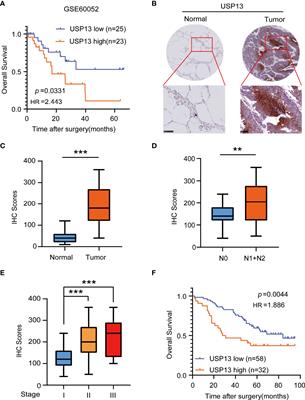 The Deubiquitinase USP13 Maintains Cancer Cell Stemness by Promoting FASN Stability in Small Cell Lung Cancer